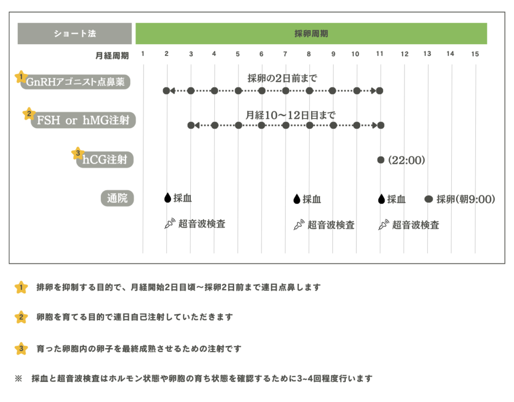 ショート法のスケジュール